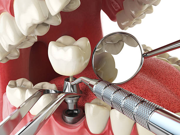 Best After-Hours Dental Care in Albion, IN