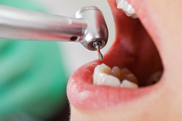 Best Weekend Emergency Dental Services in Albion, IN